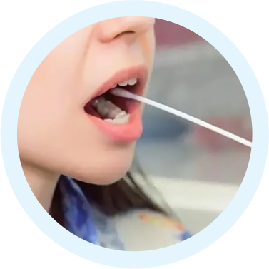 口腔拭子采样方法